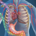 What Causes Type 2 Diabetes and How to Manage It